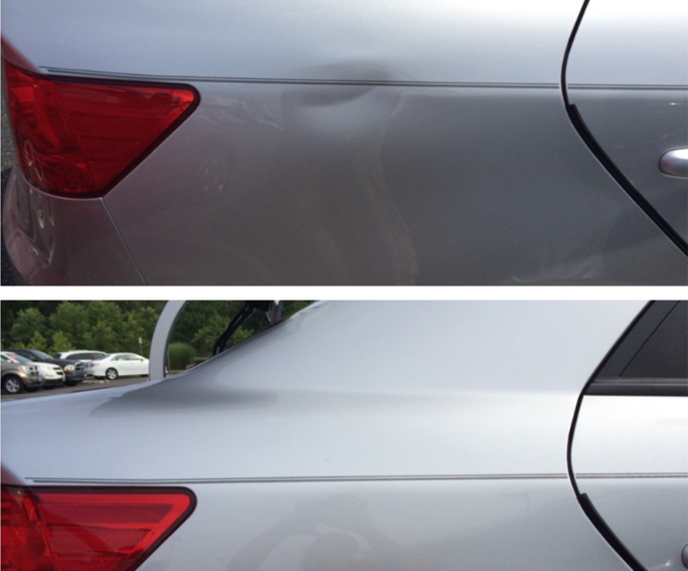 Paintless Dent Removal